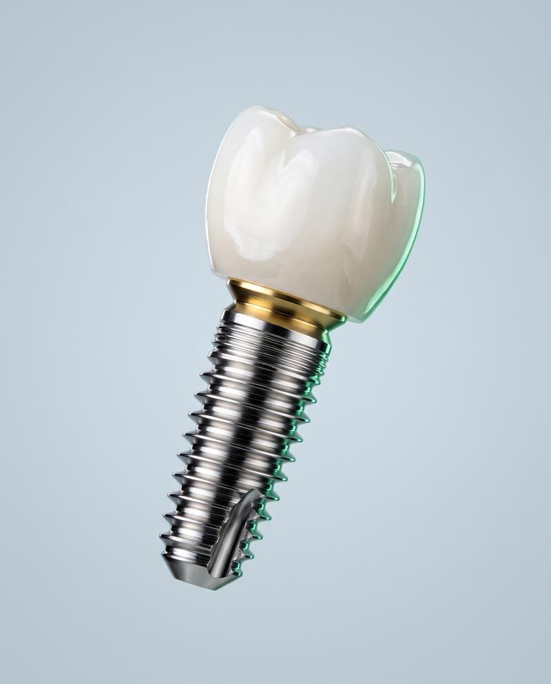 Implante dentário